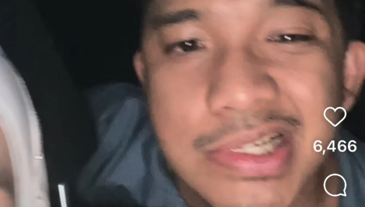 Anak Zarina Zainuddin alami Bell's Palsy