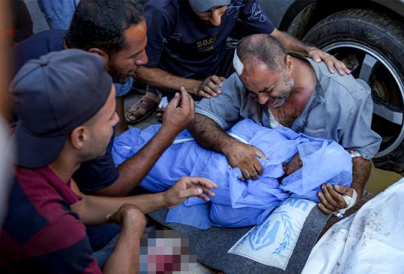 Ramai mangsa melecur teruk, hilang anggota badan dalam serangan di sekolah Gaza