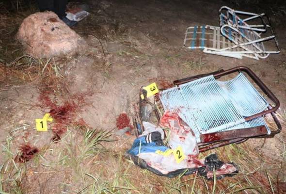 Pekerja cuci kereta maut, pengawal keselamatan cedera ditetak