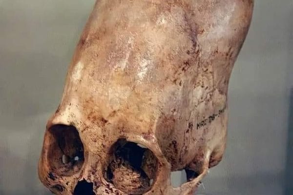 Tengkorak Paracas: Misteri Purba Yang Mencabar Pemahaman Sains"